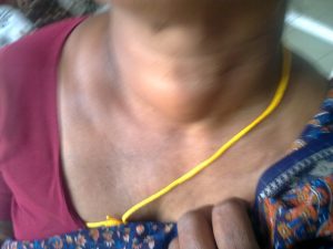 A woman's neck
